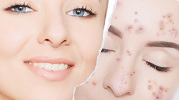 BREAK AWAY FROM BREAKOUTS & FIND YOUR CLARITY