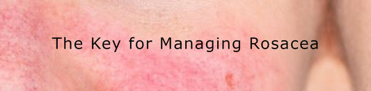 THE KEY FOR MANAGING ROSACEA - PART 3