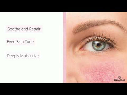 RELIEVE - The RS2 Rosacea Collection